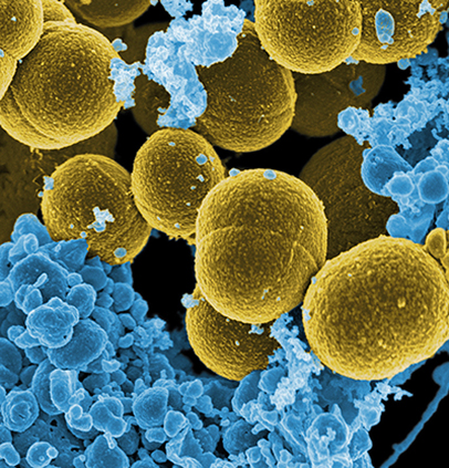 Scanning electron micrograph of S. aureus bacteria escaping destruction by human white blood cells. The image is artificially colored and shows the bacteria in yellow and the white blood cells in light blue.