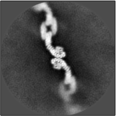 A cryo-EM image showing one of the retromer assemblies. The structure looks like two strings of protein, each shaped like a reverse “S,” laid end-on-end. The center is more in focus and the edges are blurrier.