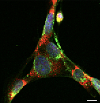 Neuro-2a cells organized in the shape of a fidget spinner. Three colors are visible: red, blue, and green on a black background. Nuclei are stained in blue, cell surface calreticulin in red, and surface membrane in green.